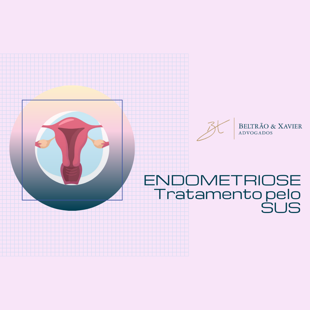 ENDOMETRIOSE | Como Conseguir Tratamento Pelo SUS